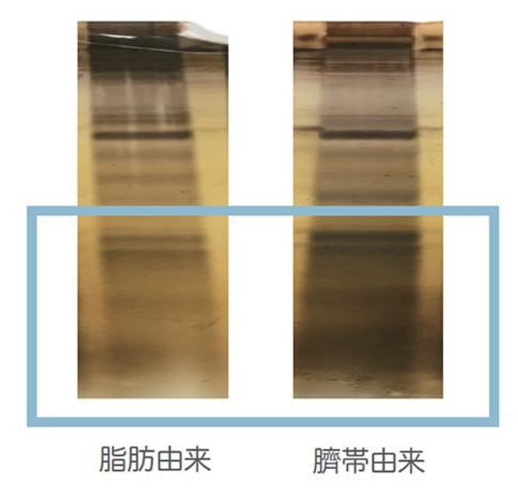 ヒト幹細胞培養上清液点滴